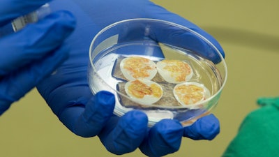 Thymus tissue for transplant to a pediatric heart patient, Duke University Hospital, Durham, N.C., Aug. 16, 2021.