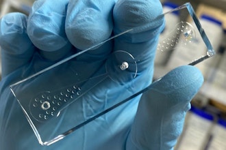 A 'worm-on-a-chip' device tracks nematodes' movements toward odor molecules produced by lung cancer cells.