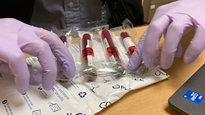 Vials of blood from a participant in a clinical study of the effectiveness of a new liquid biopsy technology are packaged for shipment at Oregon Health & Science University in Portland, Ore., on March 14, 2022. The clinical trial will follow hundreds of participants for three years to see if signals of any cancers that participants later develop were present in their blood.