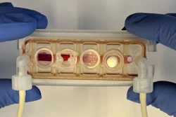 he new multi-organ chip has the size of a glass microscope slide and allows the culture of up to four human engineered tissues, whose location and number can be tailored to the question being asked. These tissues are connected by vascular flow, but the presence of a selectively permeable endothelial barrier maintains their tissue-specific niche.