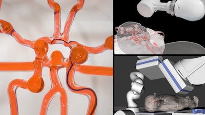 MIT engineers developed a telerobotic system to help surgeons remotely treat patients experiencing stroke or aneurysm. With a modified joystick, surgeons may control a robotic arm at another hospital to operate on a patient.