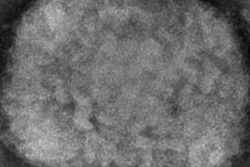 This 2003 electron microscope image made available by the Centers for Disease Control and Prevention shows a monkeypox virion, obtained from a sample associated with the 2003 prairie dog outbreak. On Wednesday, May 18, 2022, Massachusetts has reported a rare case of monkeypox in a man who recently had traveled to Canada, and investigators are looking into whether it is connected to recent cases in Europe.