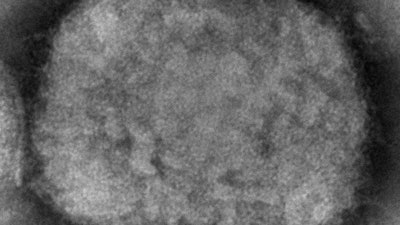 This 2003 electron microscope image made available by the Centers for Disease Control and Prevention shows a monkeypox virion, obtained from a sample associated with the 2003 prairie dog outbreak. On Wednesday, May 18, 2022, Massachusetts has reported a rare case of monkeypox in a man who recently had traveled to Canada, and investigators are looking into whether it is connected to recent cases in Europe.