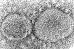 This 2020 electron microscope image made available by the Centers for Disease Control and Prevention shows SARS-CoV-2 virus particles which cause COVID-19. The coronavirus mutant that just became dominant in the United States as of May 2022 is a member of the omicron family. But scientists say it spreads faster than its omicron predecessors, is adept at escaping immunity and might possibly cause more serious disease.