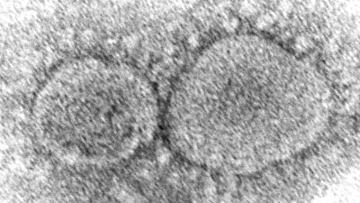 This 2020 electron microscope image made available by the Centers for Disease Control and Prevention shows SARS-CoV-2 virus particles which cause COVID-19. The coronavirus mutant that just became dominant in the United States as of May 2022 is a member of the omicron family. But scientists say it spreads faster than its omicron predecessors, is adept at escaping immunity and might possibly cause more serious disease.