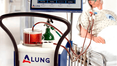 The Hemolung is a minimally invasive device that does the work of the lungs by removing carbon dioxide directly from the blood.