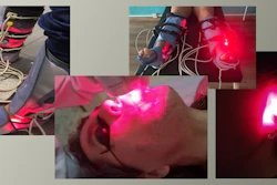 Devices that combine laser irradiation, ultrasound and suction help regenerate tissue and treat muscle, joint, skin, neurological and lung damage.