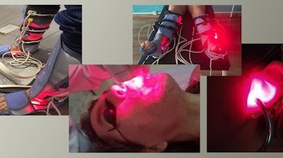 Devices that combine laser irradiation, ultrasound and suction help regenerate tissue and treat muscle, joint, skin, neurological and lung damage.