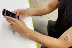 The device can be worn on the upper arm and sends data wirelessly to a custom smartphone app.