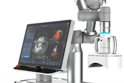 HistoSonics' Edison system, currently in development, uses the novel science of histotripsy to non-invasively destroy targeted liver tissue.