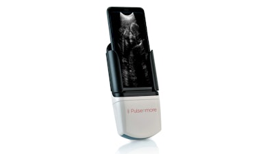 Pulsenmore has developed a self-operated prenatal home ultrasound solution that can be combined with a smartphone.