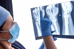 X-ray accounts for a majority of imaging procedures in hospitals in the U.S.