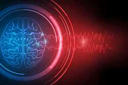 The study is the first to examine whether shunts increase brain shift.