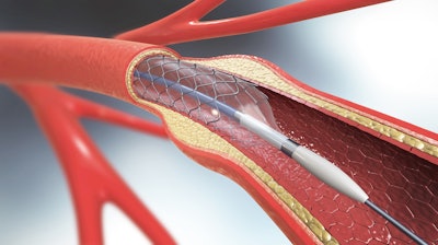 Medtronic Gets FDA Approval for Drug-Eluting Stent