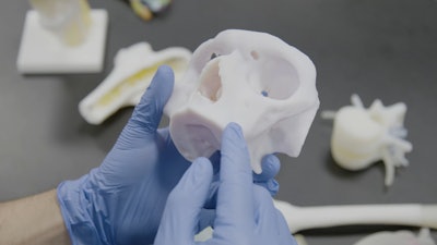 3D-printed anatomic model.