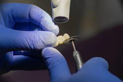 High-speed bearings are crucial in dentistry tools that can rotate at speeds of up to 400,000 RPM.