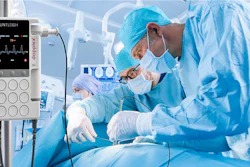 Single-Use, Sterile Intraoperative Probe DMX Doppler System.