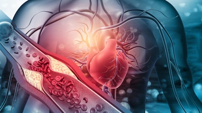 The Elucid platform is an FDA-Cleared and CE-Marked software to objectively quantify plaque morphology.