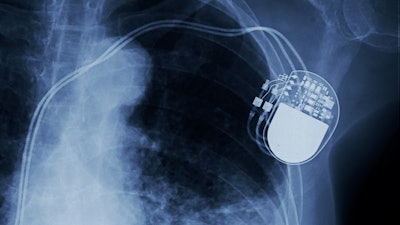 Abbott said the data reinforces the capabilities of its structural heart solutions