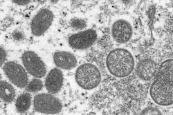 This 2003 electron microscope image made available by the Centers for Disease Control and Prevention shows mature, oval-shaped monkeypox virions, left, and spherical immature virions, right, obtained from a sample of human skin associated with the 2003 prairie dog outbreak. The spread of monkeypox in the U.S. in 2022 could represent the dawn of a new sexually transmitted disease, or it could yet be contained. Or it might be too early to tell.