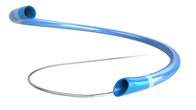 A neurovascular extension catheter is a newer approach that provides greater aspiration power to the small, distal vessels.