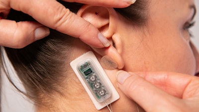 The First Relief percutaneous neurostimulation device can be used to treat pain related to diabetic neuropathy. It is applied behind the ear and delivers continuous pulses of a low-level electrical current over several days.