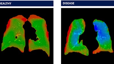 4 D Medical Xv Scans