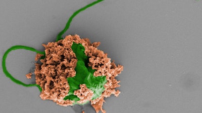 Colored SEM image of a pneumonia-fighting microrobot made of an algae cell (green) covered with biodegradable polymer nanoparticles (brown). The nanoparticles contain antibiotics and are coated with neutrophil cell membranes.