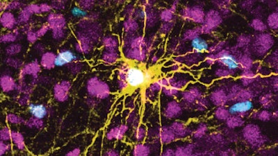 This microscope image provided by Pasca Lab/Stanford Medicine shows a human astrocyte cell, center in yellow, and human glial cells (scattered in blue) inside the brain of a rat.