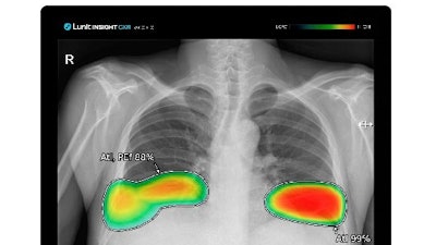 Lunit Insight Cxr Lunit S Ai Solution Chest X Ray Image Analysis