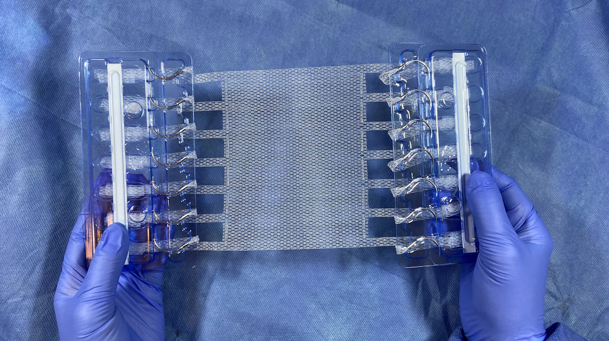 Sublay Only FDA OKs Sublay Application in Hernia Surgery | Medical Design & Development