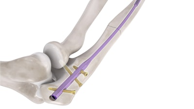 Conventus Flower Orthopedics