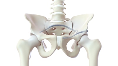 Curvafix Pelvis Exhibit 04 02 01