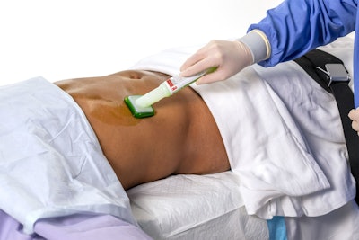 3 M Patient Preoperative Skin Preparation