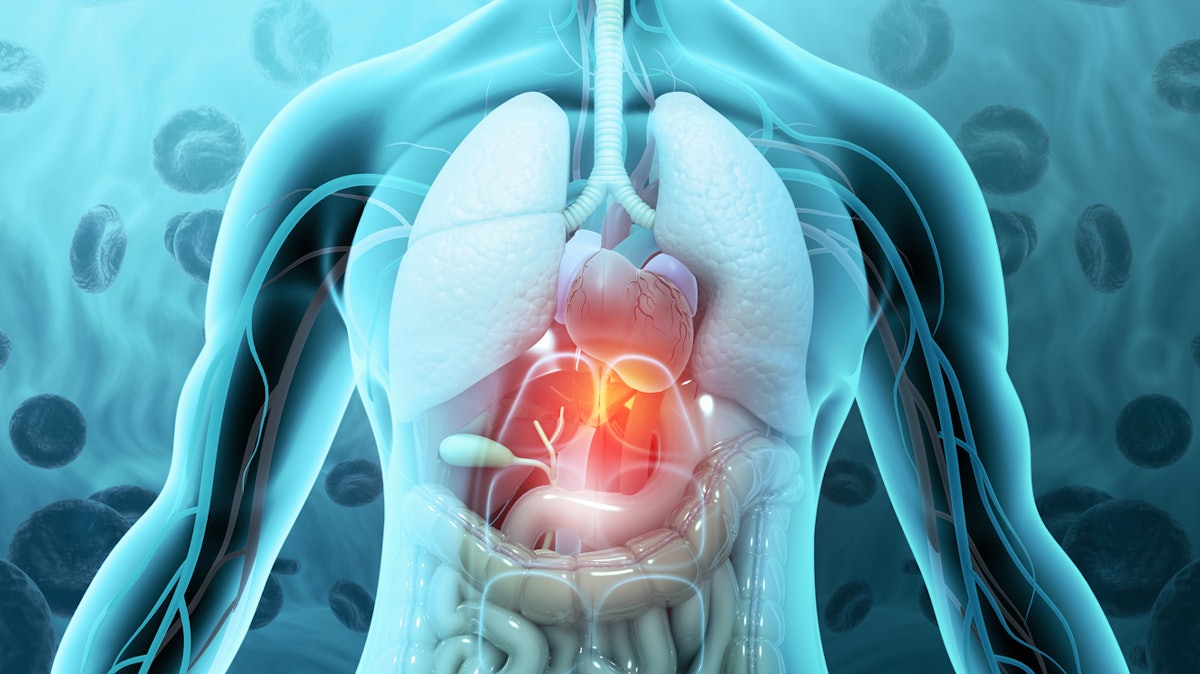 CareDx, Miromatrix Partner on Bioengineered Organs for Human ...