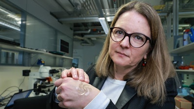 Stéphanie Lacour holds the deployable electrode, developed at EPFL.