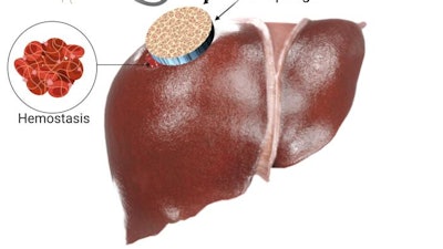 Low Res Theranostic Hemorrhage Control