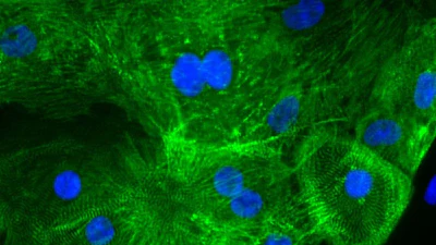 Heart cells derived from human stem cells stained for muscle protein (green) and nuclei (blue).