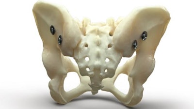 Bone