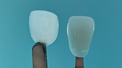 Ultrathineer Vs Regular2