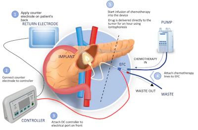 Act Iop 003 System Image