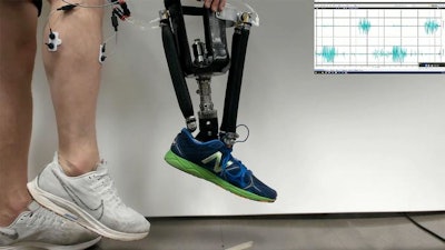 Demonstration of the robotic prosthetic ankle. Electromyographic sensors (on calf at left) capture electrical activity generated by muscles when they are flexed. This signal tells the prosthesis which artificial muscle to flex and how much to flex. For individuals with amputation, these sensors are placed in the prosthetic socket. The graph (right) shows the electromyographic signal, which is used to control the prosthesis.