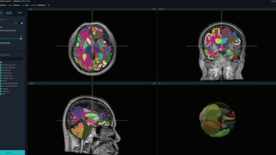 Vuno Vuno Med Deep Brain