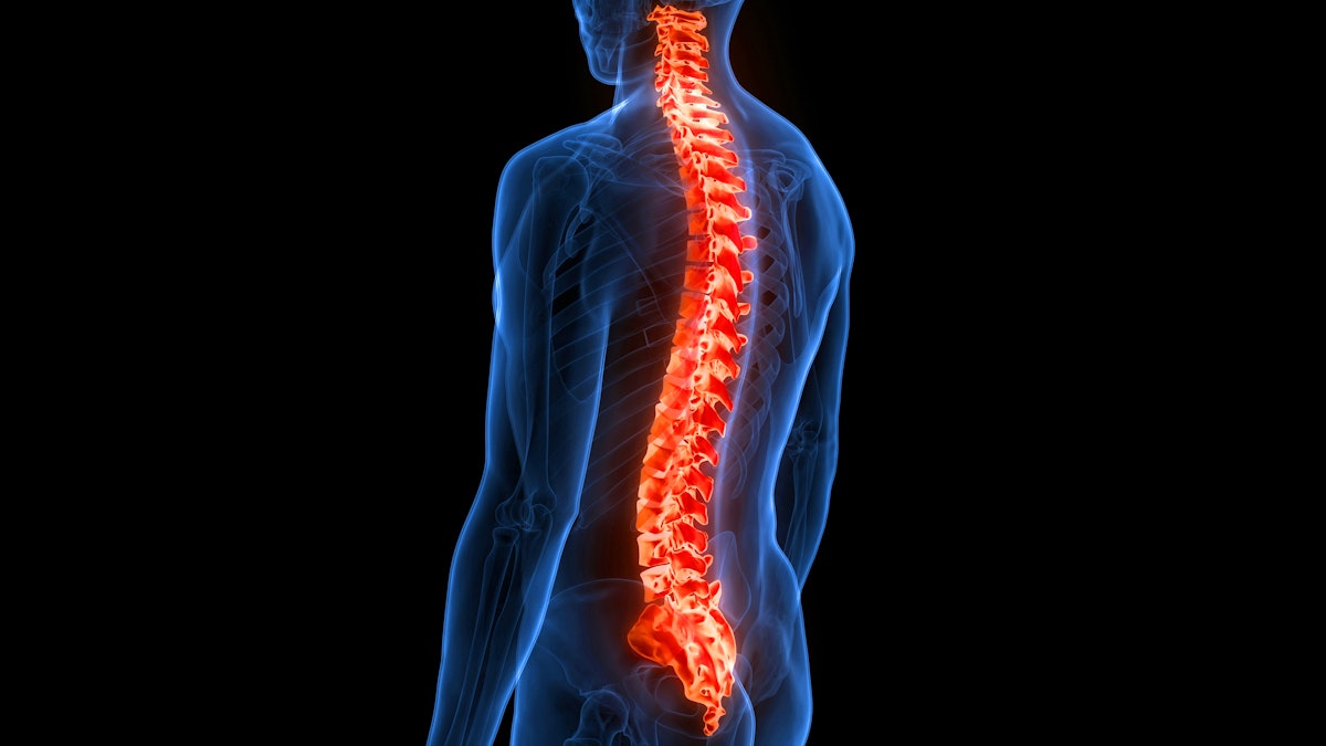 Spinal cord stimulation: a nonopioid alternative for chronic pain