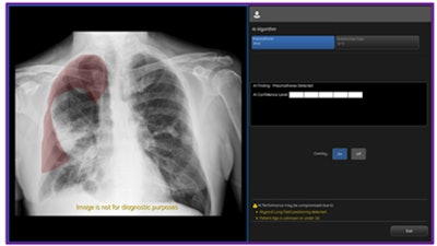 Critical Care Suite 2 1 Ptx Image 1 L