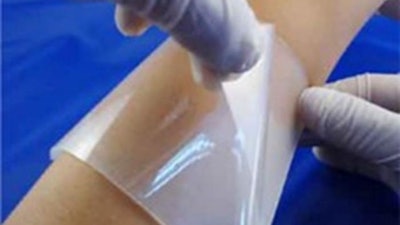 Conventional wound management techniques like suture and stapling have several drawbacks. Tissue adhesive patches made from hydrogels could be a good alternative solution to accelerate the wound healing process, since they can be functionalized with healing agents and their mechanical properties can be fine-tuned.
