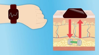 Low Res Injectable Glucose Monitor