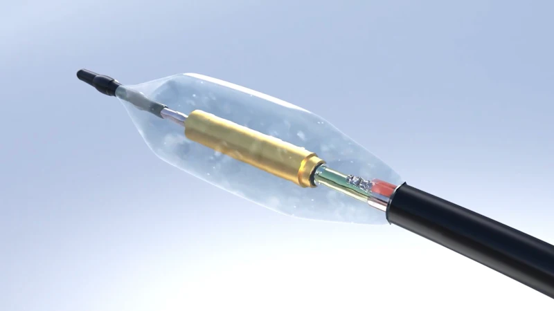 Recor Medical Launches Ultrasound Renal Denervation System | Medical ...