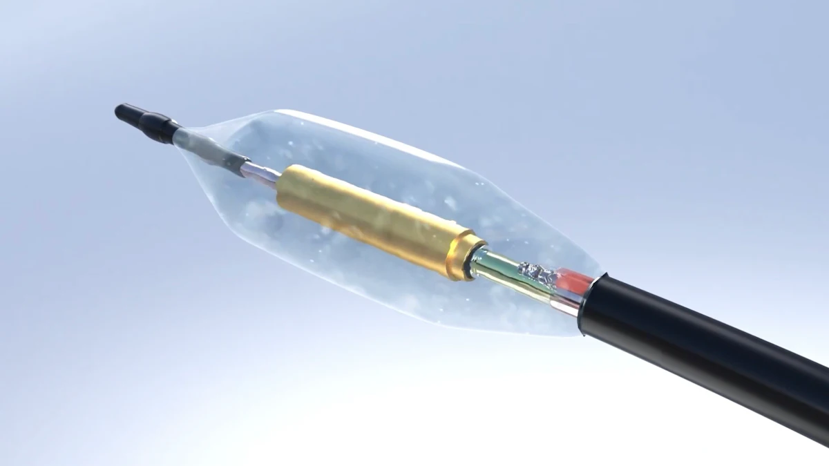 Recor Medical Launches Ultrasound Renal Denervation System | Medical ...