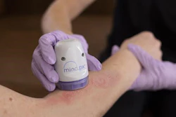 Minderahealth Mindpx